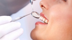 Распространенные стоматологические заболевания и их особенности